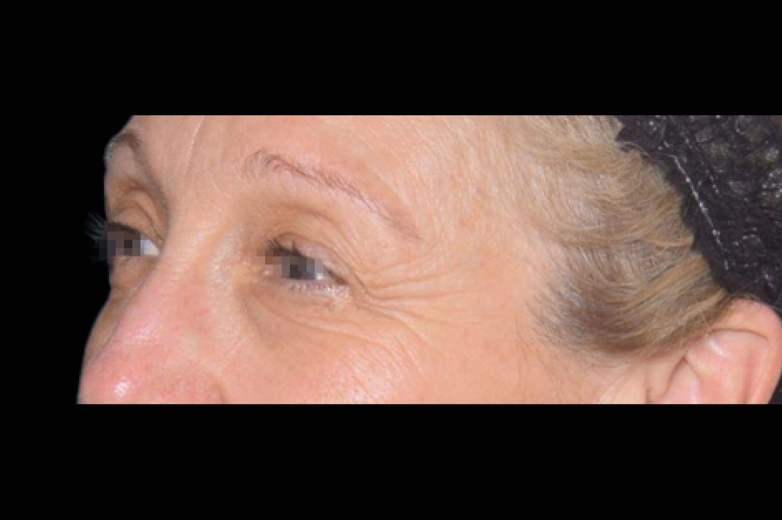 exion-before-and-after-1-scaled.jpg exion-before-and-after-1-scaled.jpg