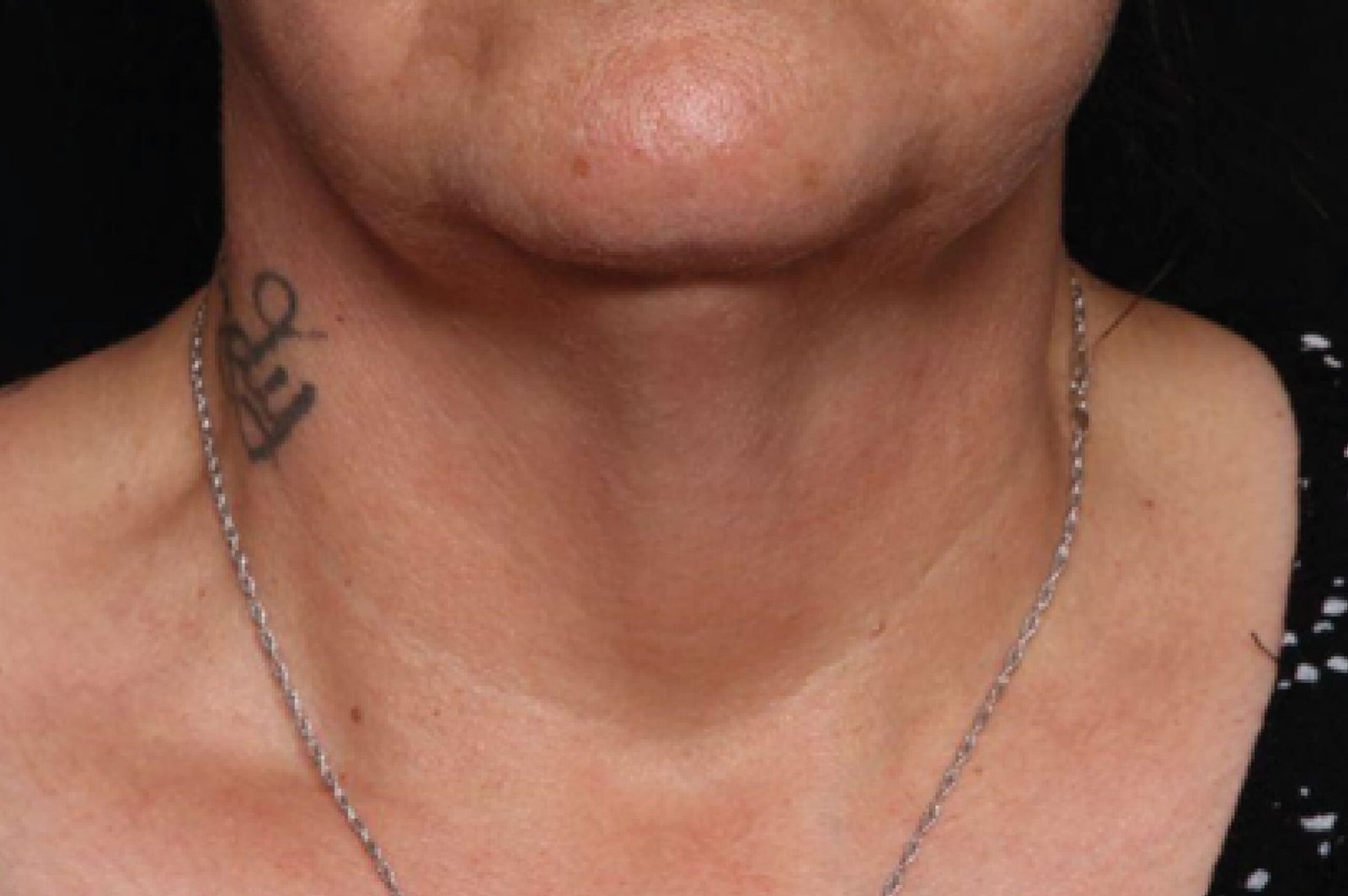 exion-before-and-after-3-scaled.jpg exion-before-and-after-3-scaled.jpg