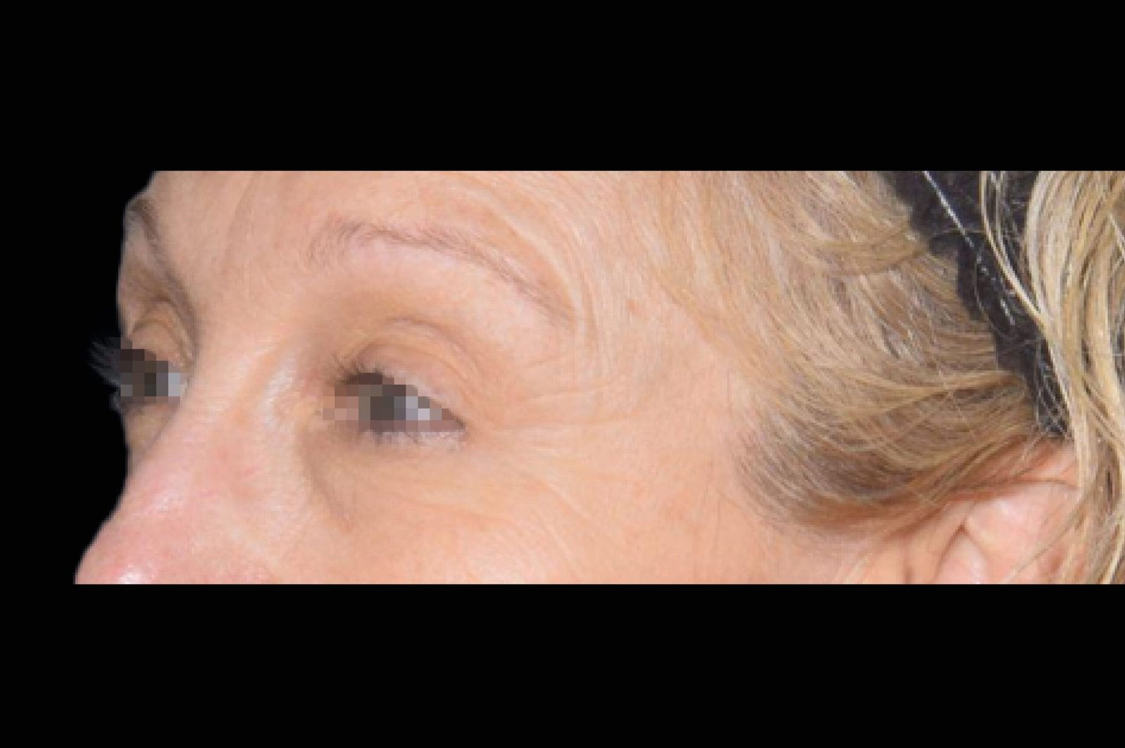 exion-before-and-after-4-scaled.jpg exion-before-and-after-4-scaled.jpg