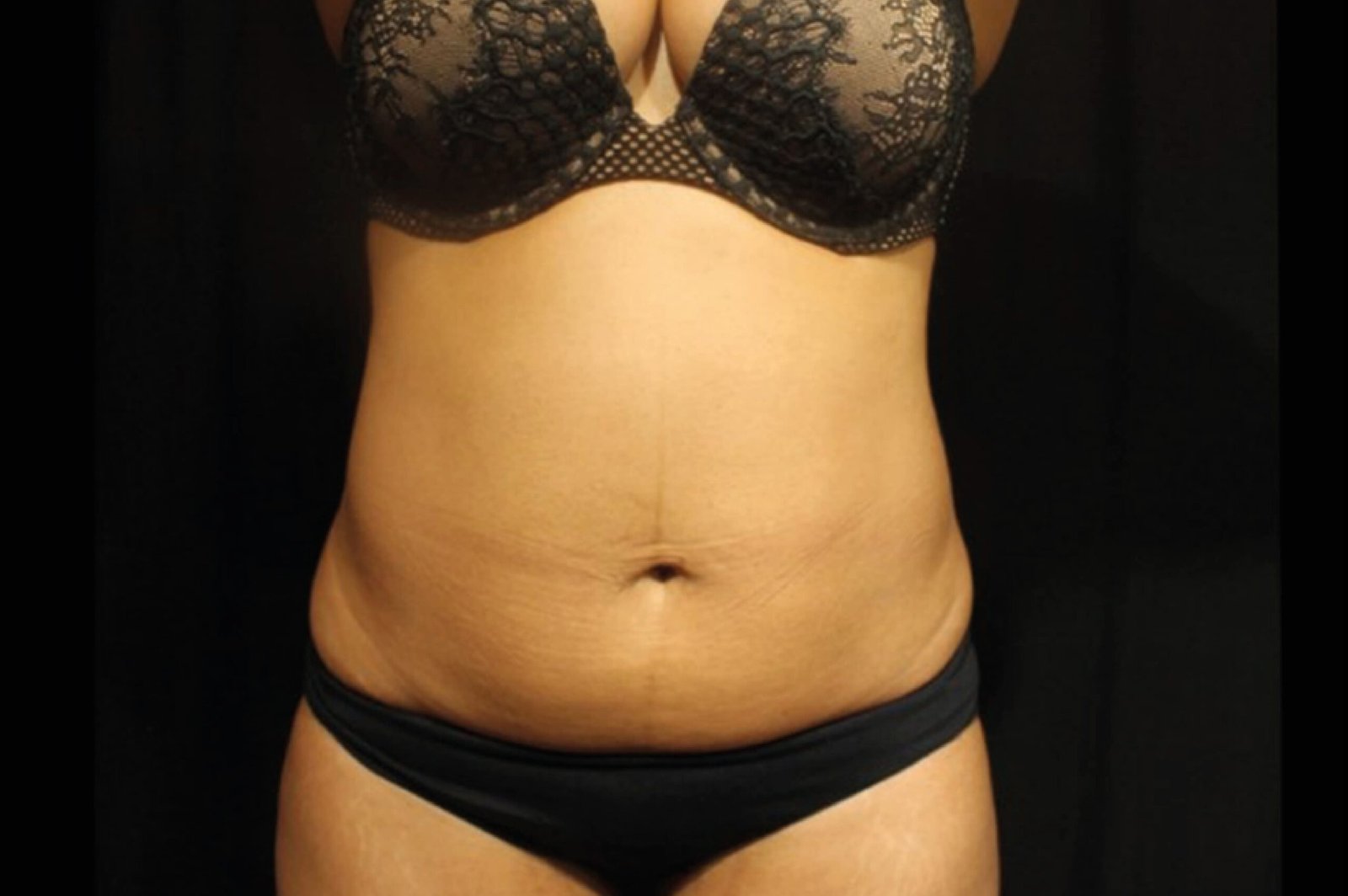 emtone-before-after-6-scaled.jpg