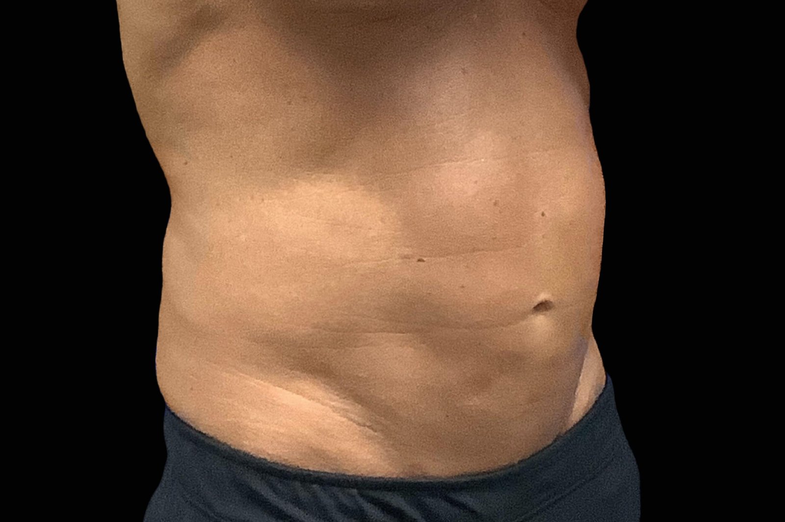 emtone-before-after-7-scaled.jpg