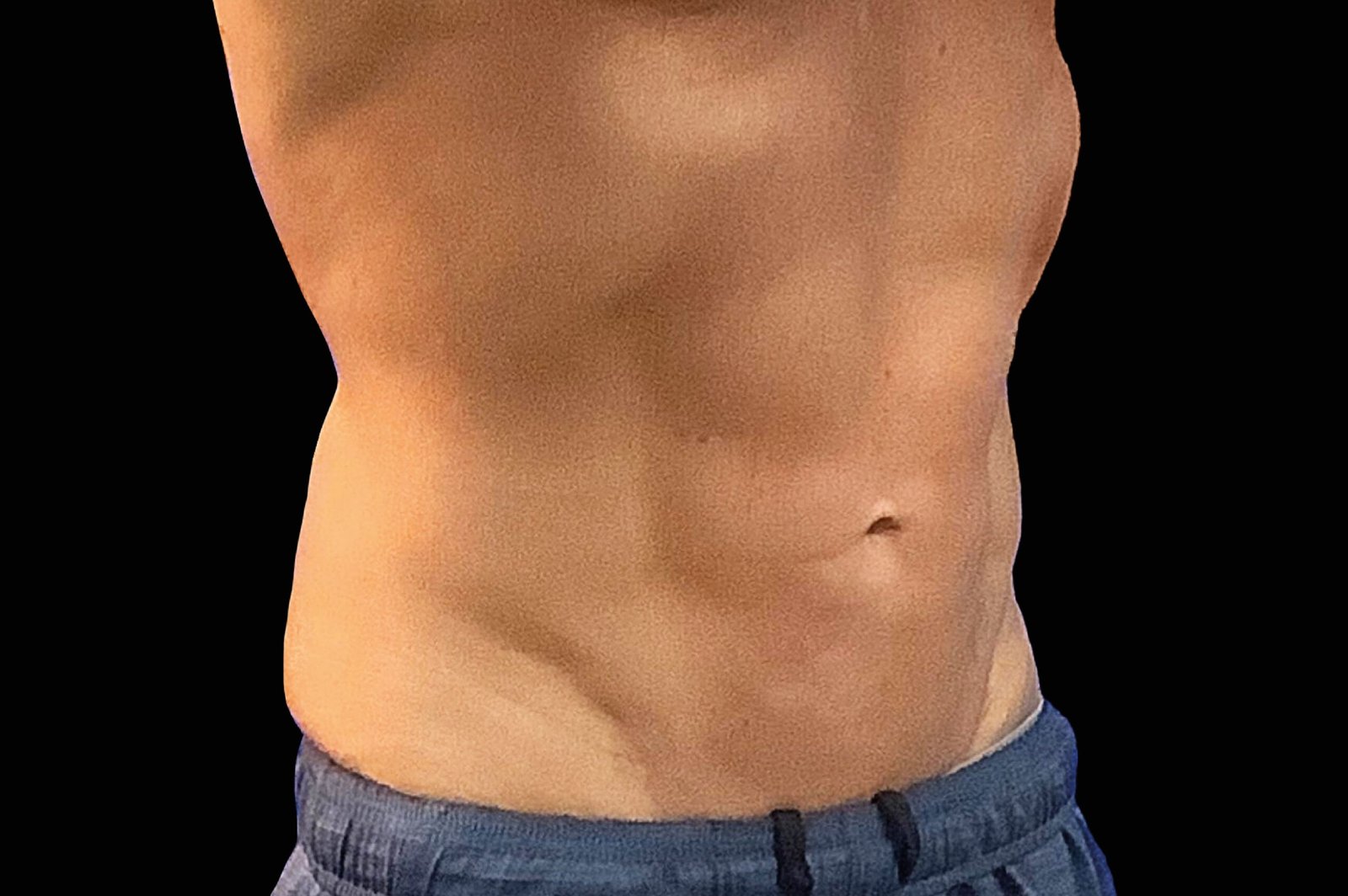 emtone-before-after-9-scaled.jpg