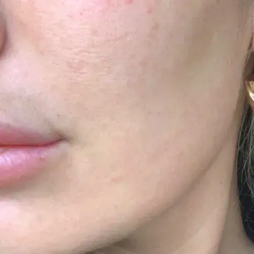 poly_Face_After