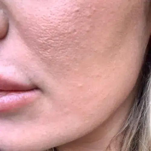 poly_Face_Before